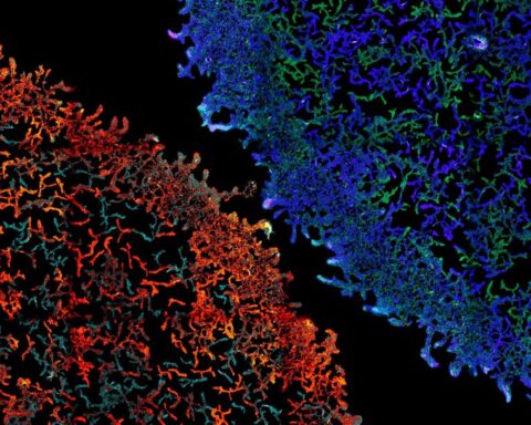 Estudio de la Universidad de Oxford revela posibilidades para contrarrestar nuestra dependencia a los antibióticos