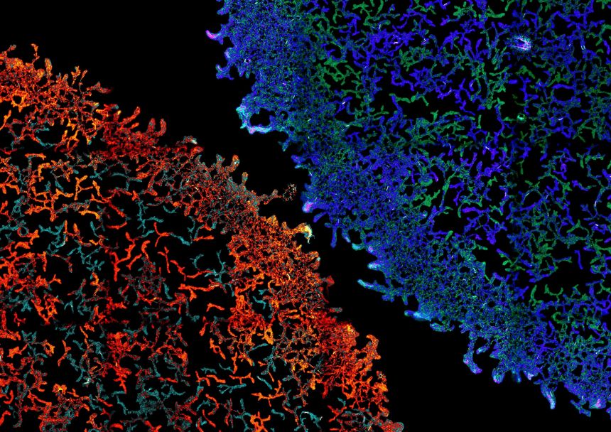 Estudio de la Universidad de Oxford revela posibilidades para contrarrestar nuestra dependencia a los antibióticos